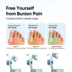 Bunion Corrector for Big Toe