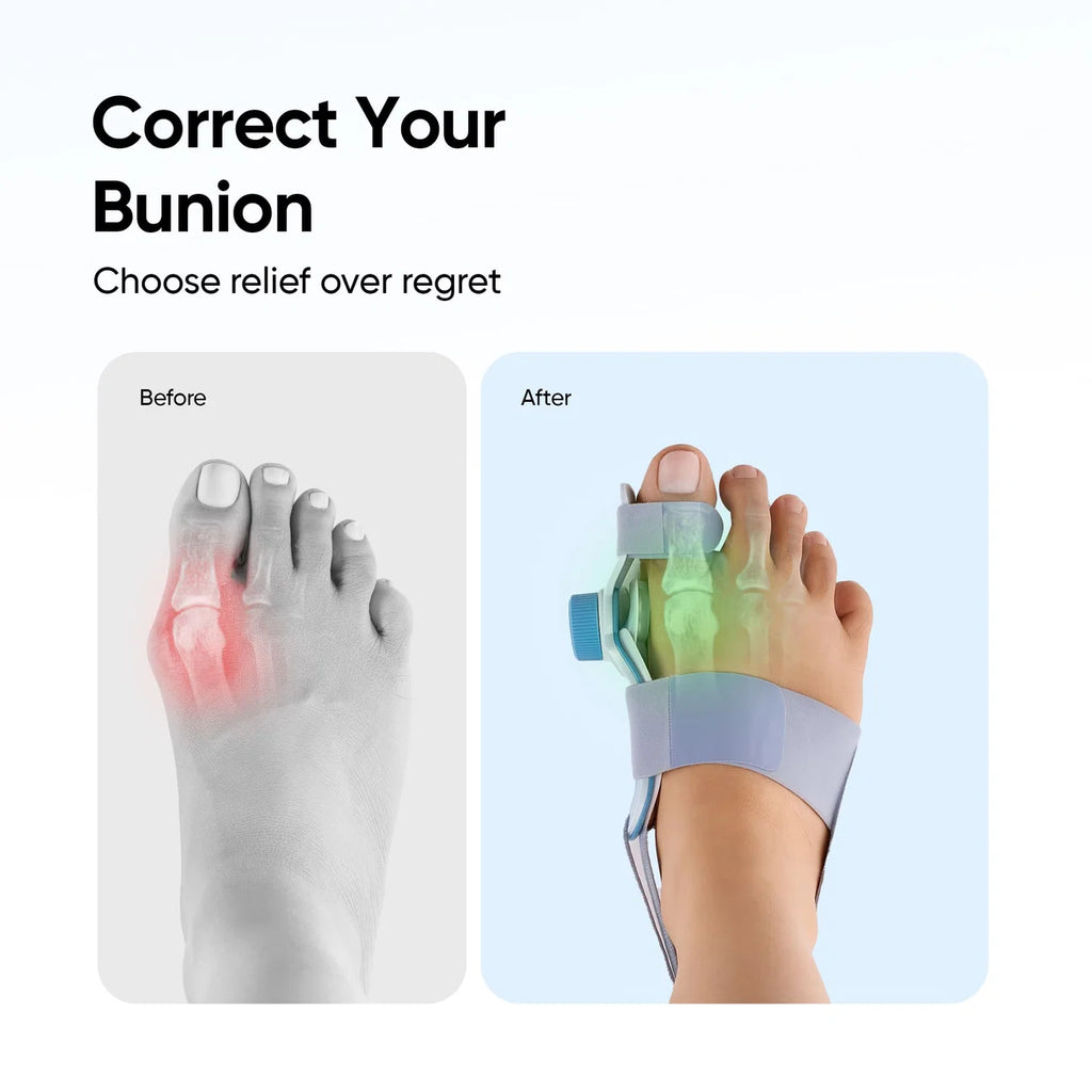 Bunion Corrector for Big Toe